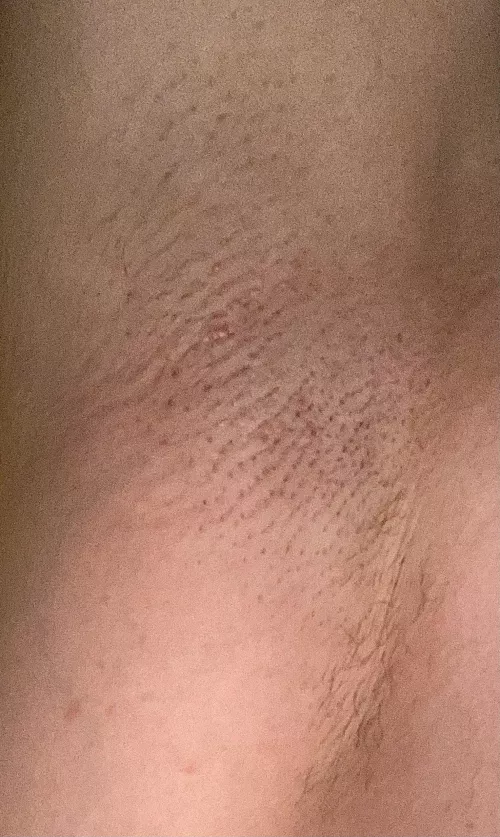 Had to shave them for a date last night 😢 by sunnypits