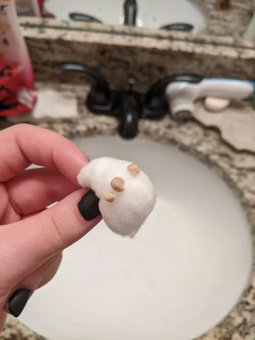 Had what I thought was one small tonsil Stone bothering me all day, finally got it out and it was three of them, thought y'all would want to see by moodlecake