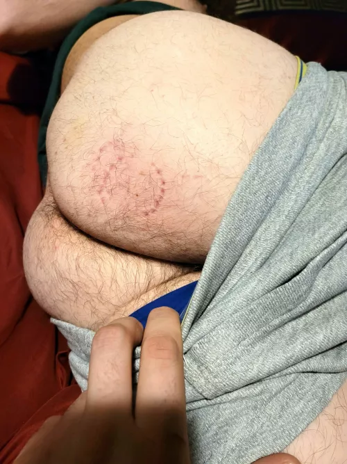 Hair and bite marks 😋 by Logan_Luke_OF