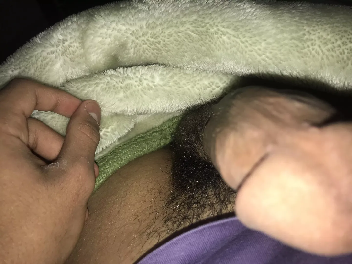 Hairy posted by International-Cost12