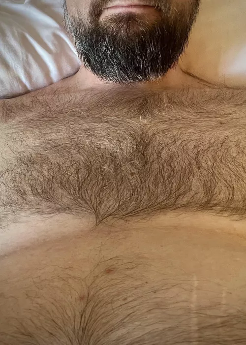 Hairy enough? by DocThrowaway1987