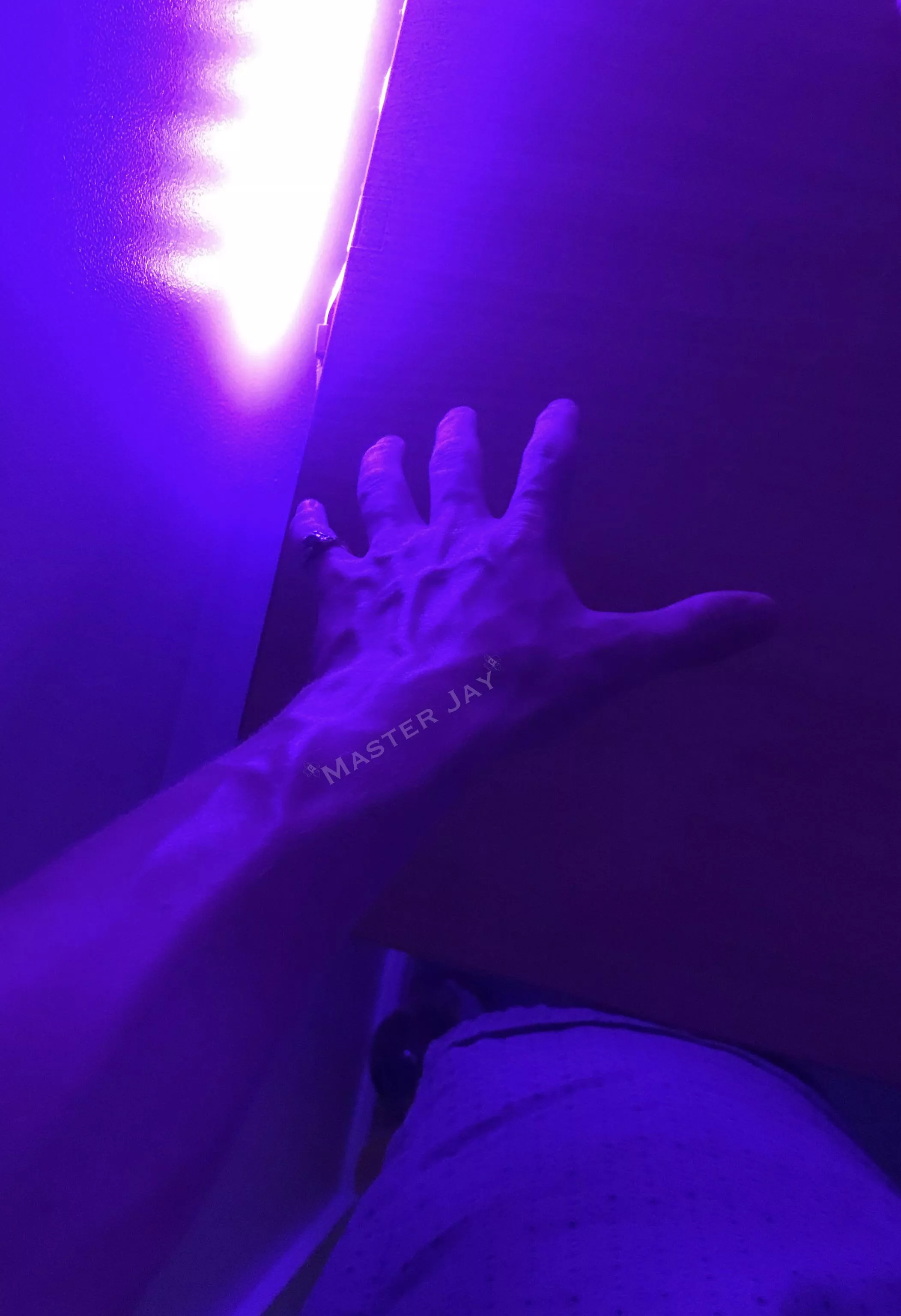 Hand and forearm posted by xMasterJay