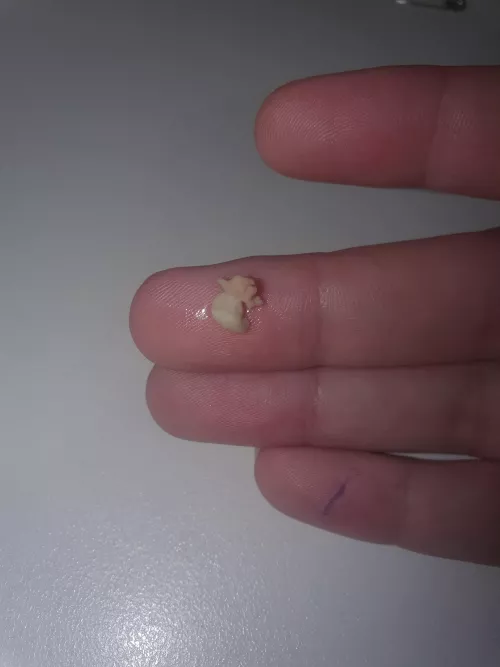 Have felt like there was a piece of popcorn in my throat all day, finally had a chance to check and this came out by yeahnasweetasbro
