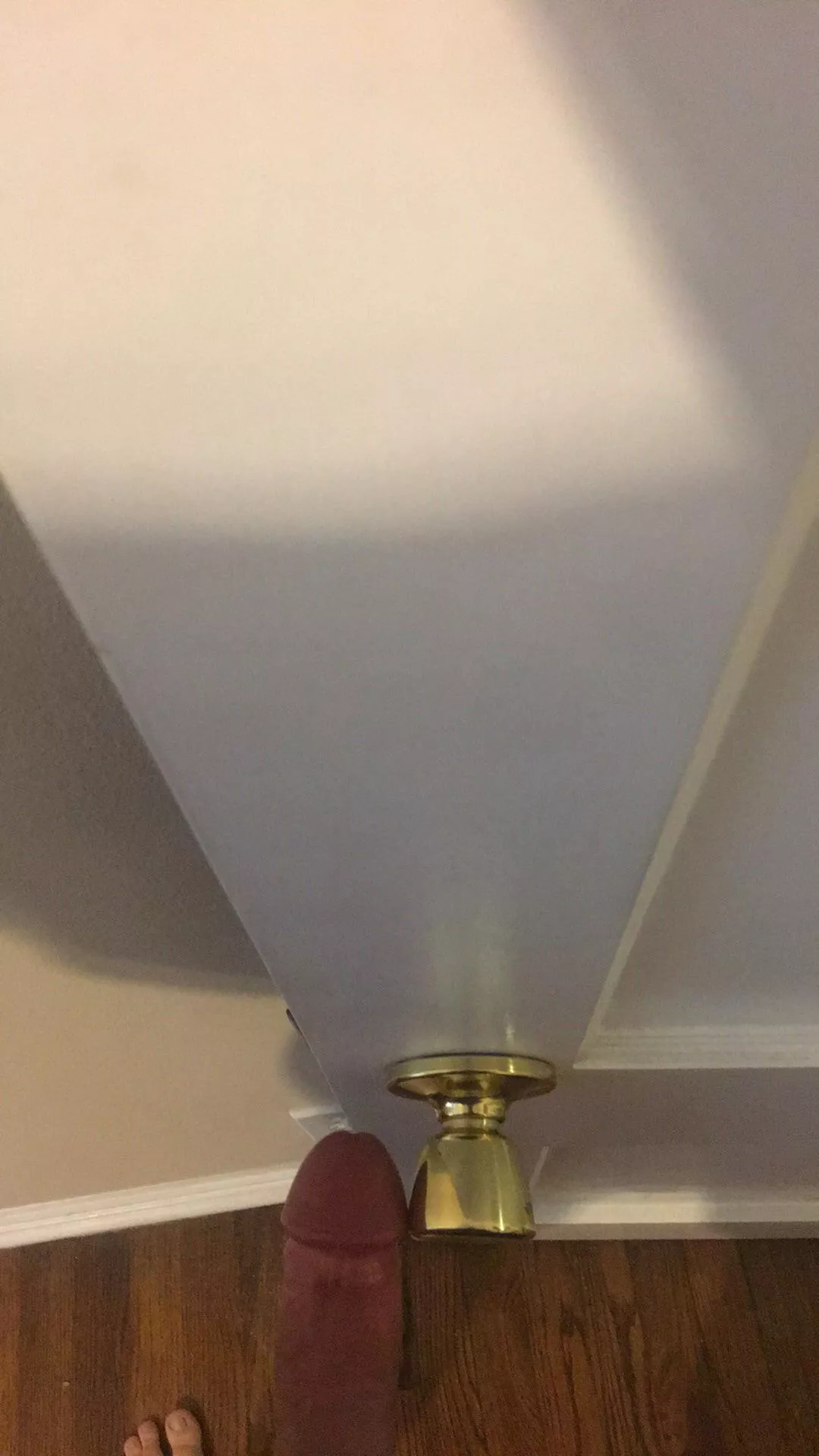 Head like a door knob posted by anonymoose23456