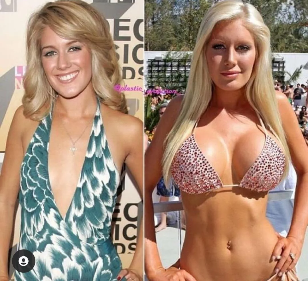 Heidi Montag posted by GermyPsettichthys