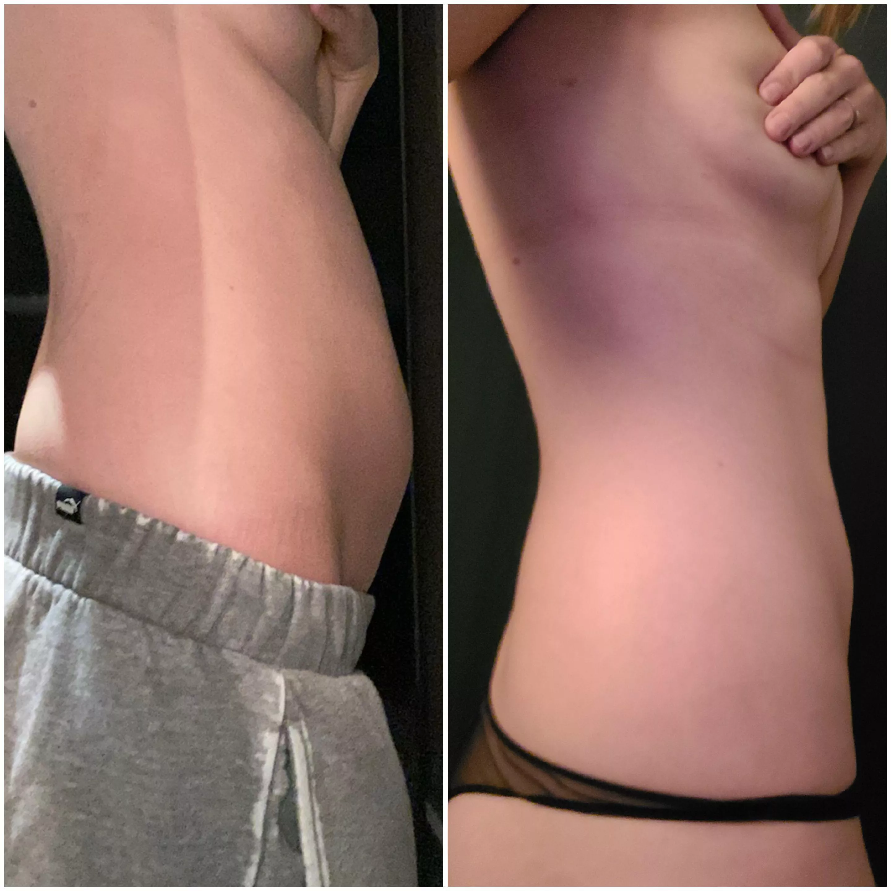 Help me gain! Less than 24 hours later 😭 posted by lexiecalderaxo