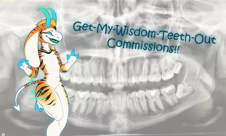 Help-get-my-wisdom-teeth-out commissions! by 32RabbitTeeth