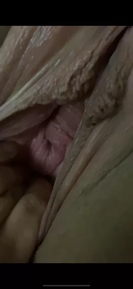 Here’s a better one of her cervix by dodgeguy222