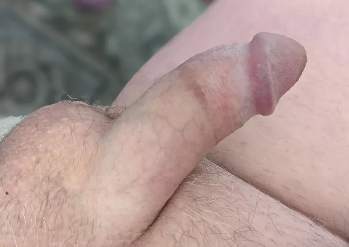 He's bored playing with himself looking for a playmate [61] by Gullible-Service1479