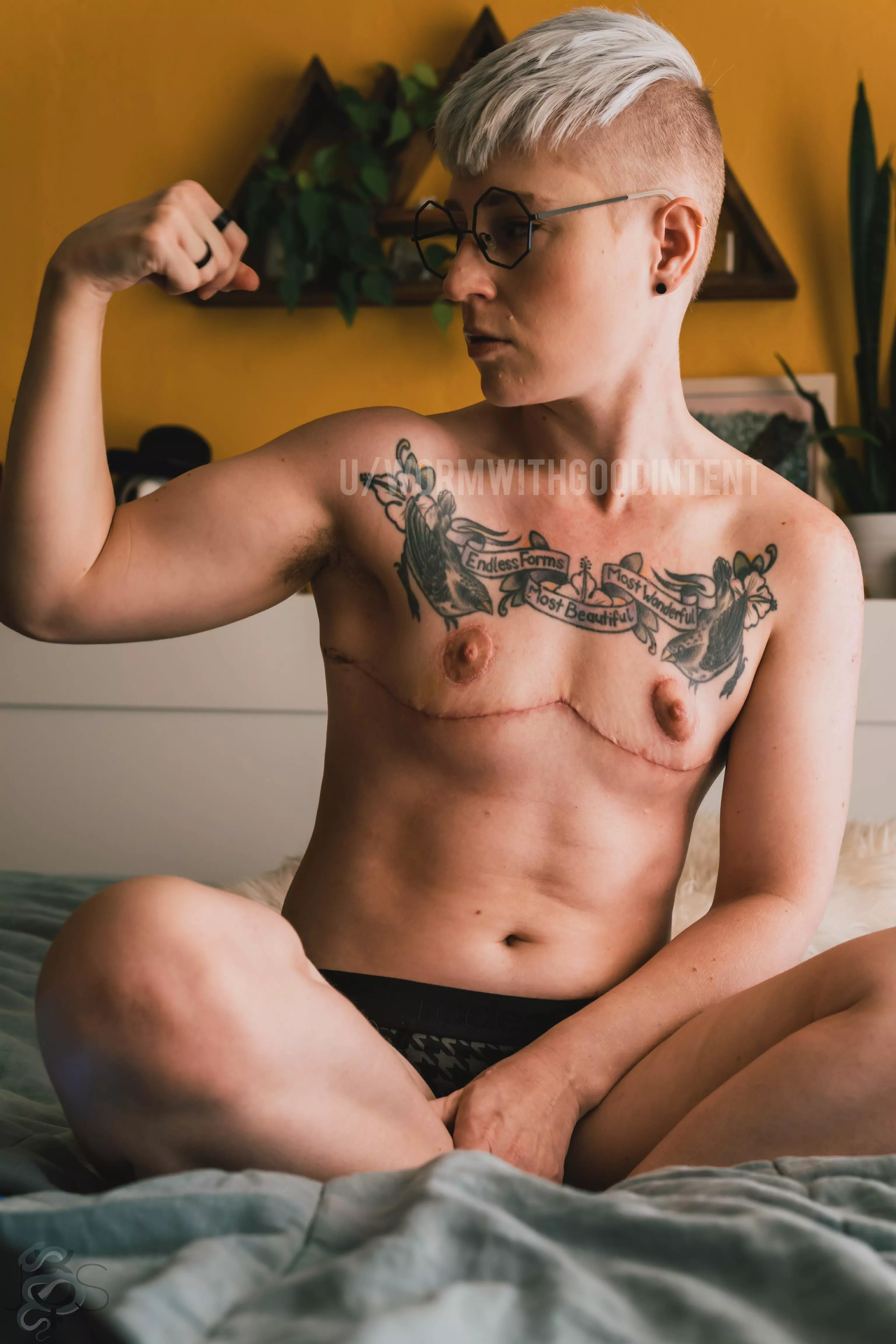 Hey r/bois. I got top surgery!!! I’m officially part of the tiny tibbies gang. Do you still love me? 🥺👉🏻👈🏻 posted by WormWithGoodIntent