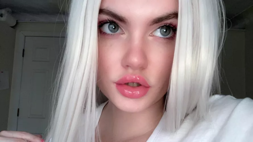 Hi i got more lip filler today! Will be getting it every monthish now and tits in May! by Bimb0esque