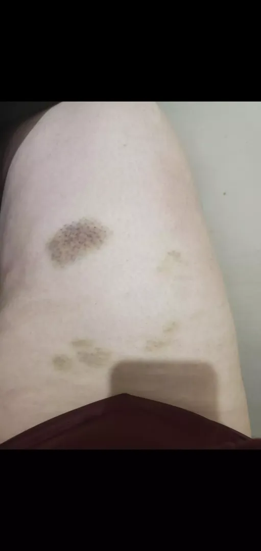 Hi I'm new 😊 posted by smolbastard