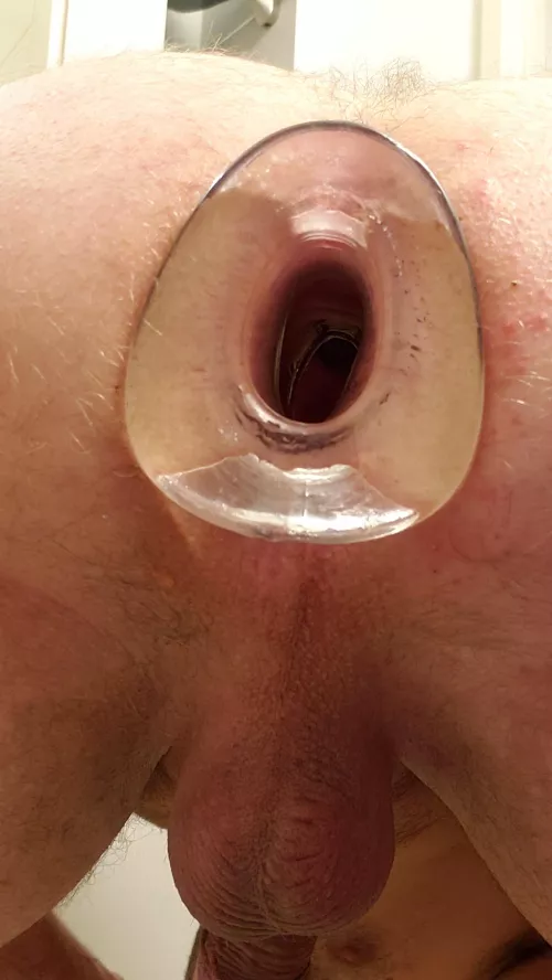 Hollowed out by pervyanus