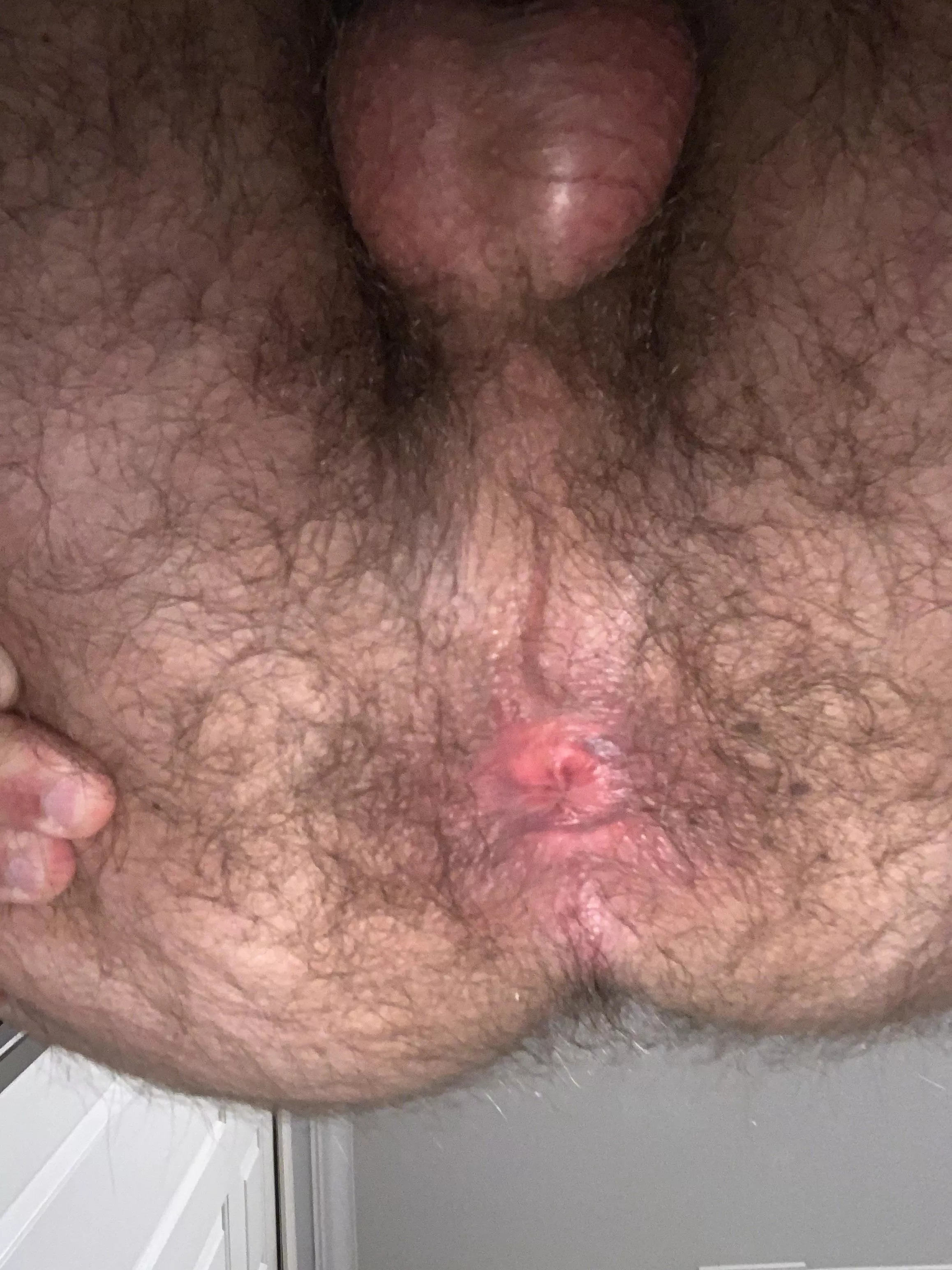hope you enjoy my first taint pic ;) posted by RoboTRex345