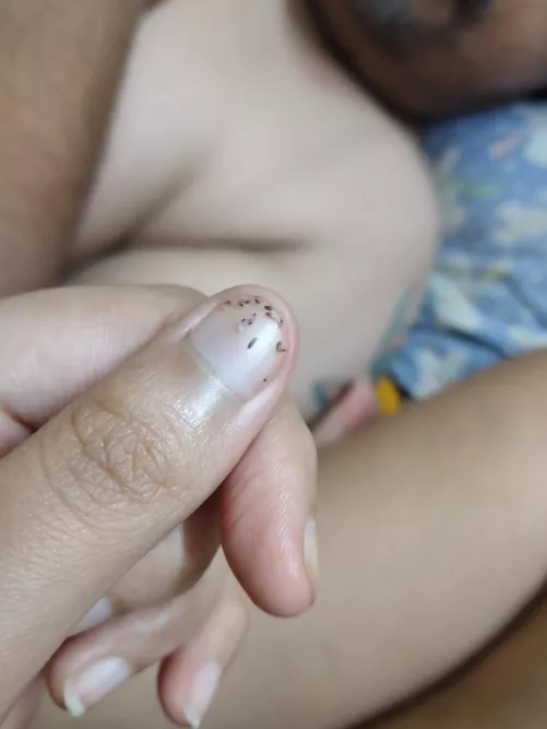 Host of blackheads from the boyfriend's underarm. They refill every few weeks and are pretty much a gift that keeps on giving by not_ajanta