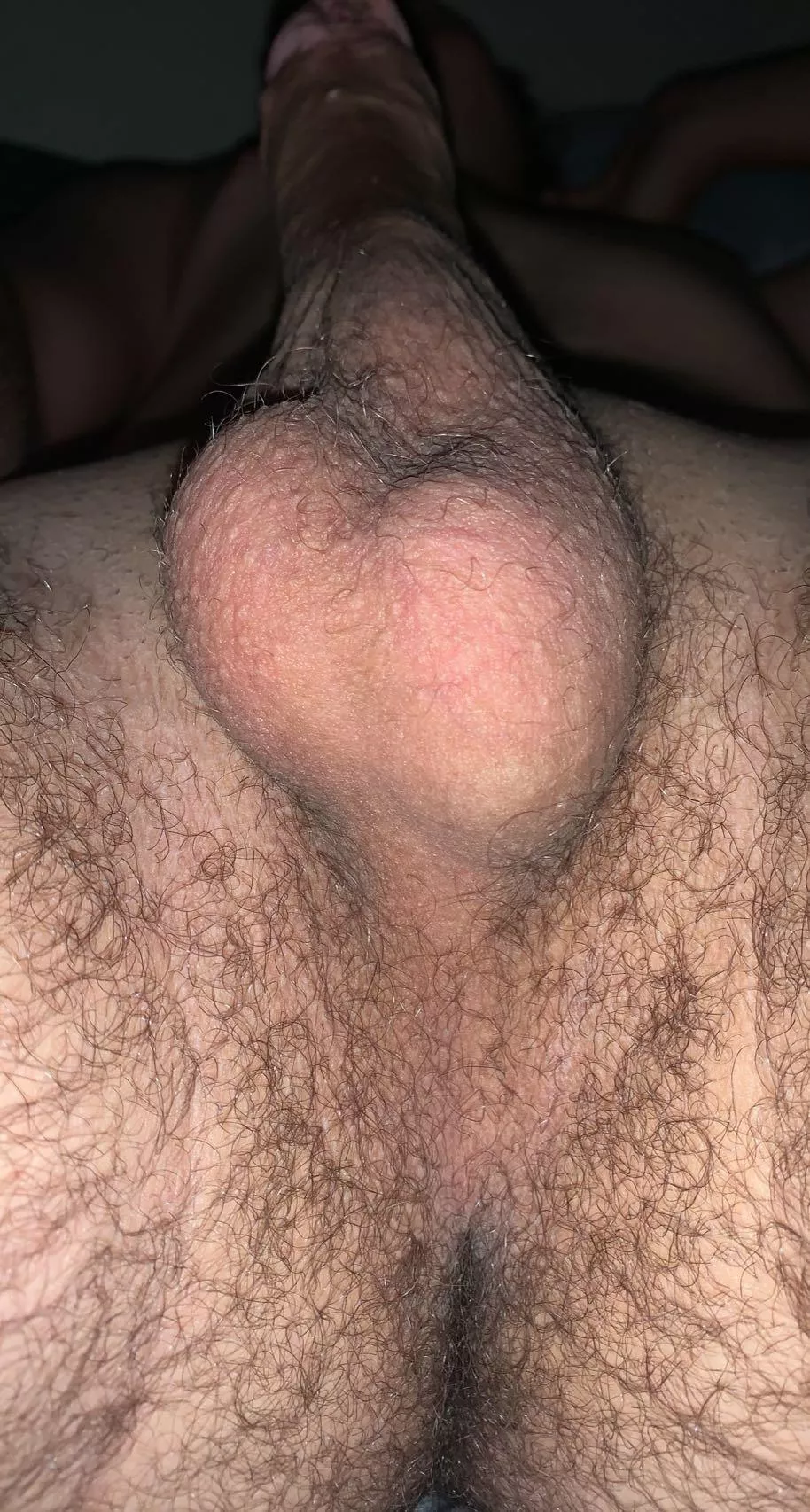 How are my balls and taint looking? posted by Prize-Remarkable