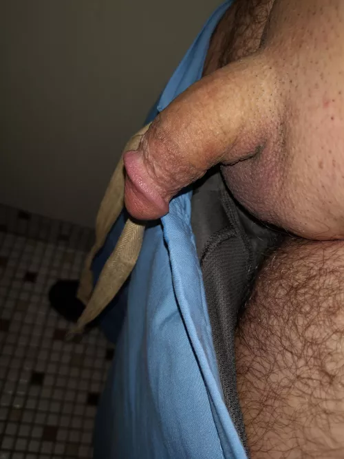 How does it look? 54 yo by No-Abbreviations7363