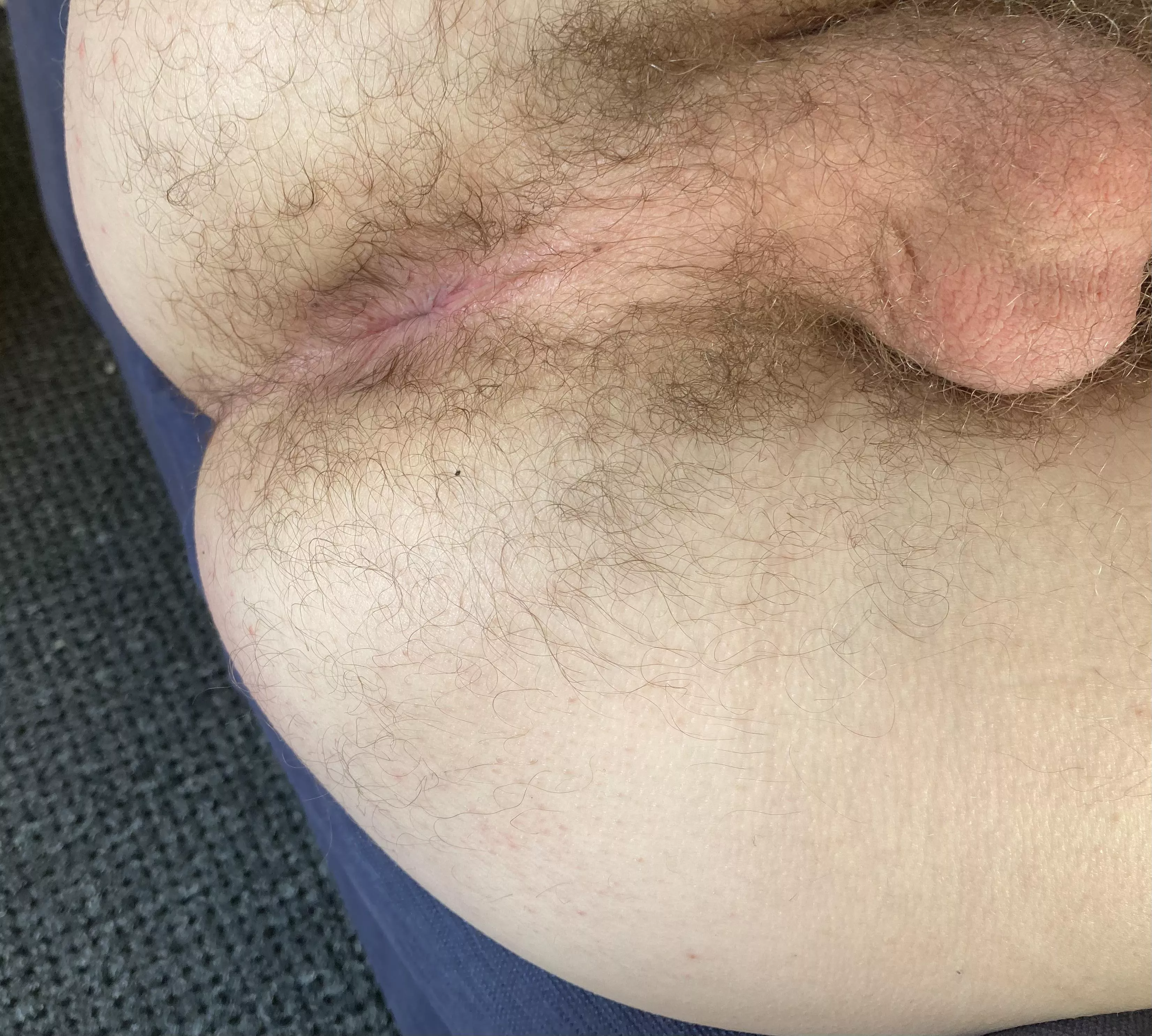 How’s my hairy taint look? 22M posted by cursedpastajpeg