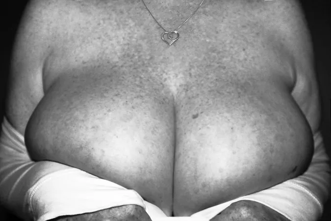Huge Freckled Boobs in B&W by MissEmilyGrey