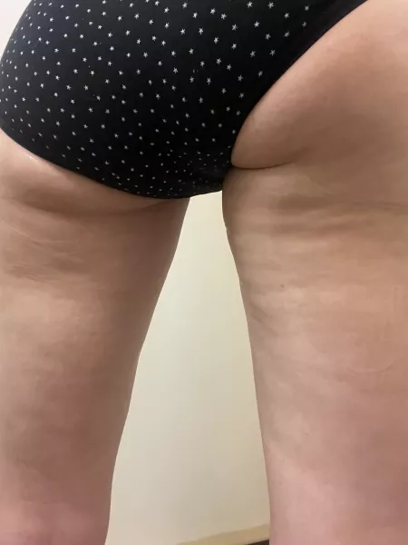 Husband Disgusted With Sexy Cellulite by bugsnchickens