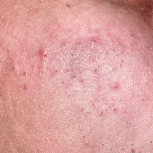 husband doesn't let me pop them by CharlesHolmes1998