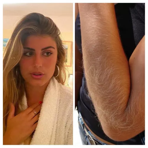 I always get teased because of my arms, are they really that hairy?? 😕 by Live_Finger_9607