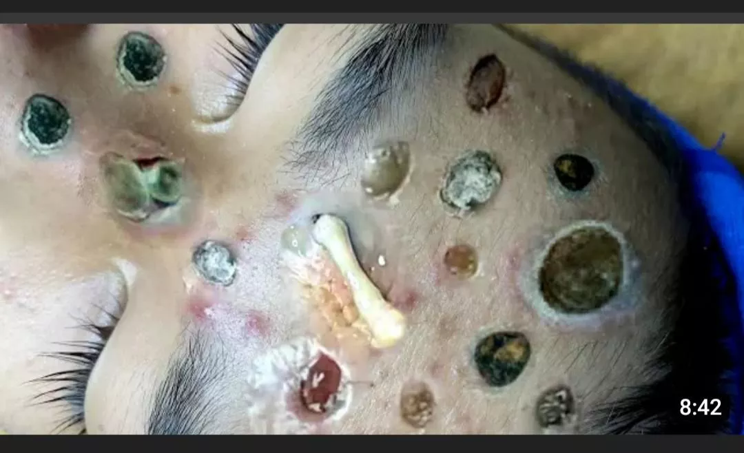 I can still see some skin without a ridiculous large and badly edited blackhead/pore/pimple - far from realistic thumbnail of a YouTube video. All their thumbnails look like this posted by Kirschenkind