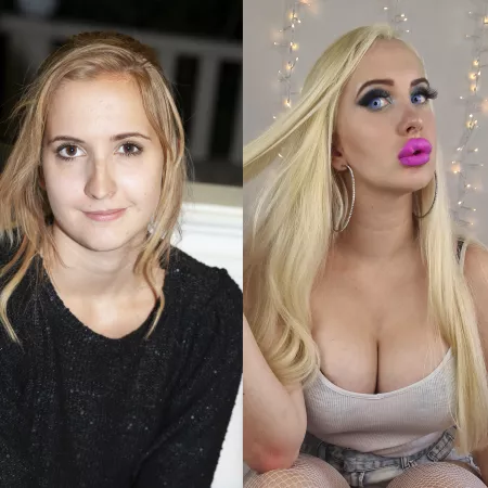 I get 2 more ml in my lips in 6 days and my expanders in spring 2022 😍 by Vivian_Rose1