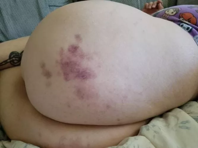 I got a bit carried away with my fwb by lilBenztruc