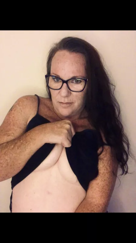 I got a lot of freckles. It’s where the sun kissed me 😘🌞 by Siennaxxx