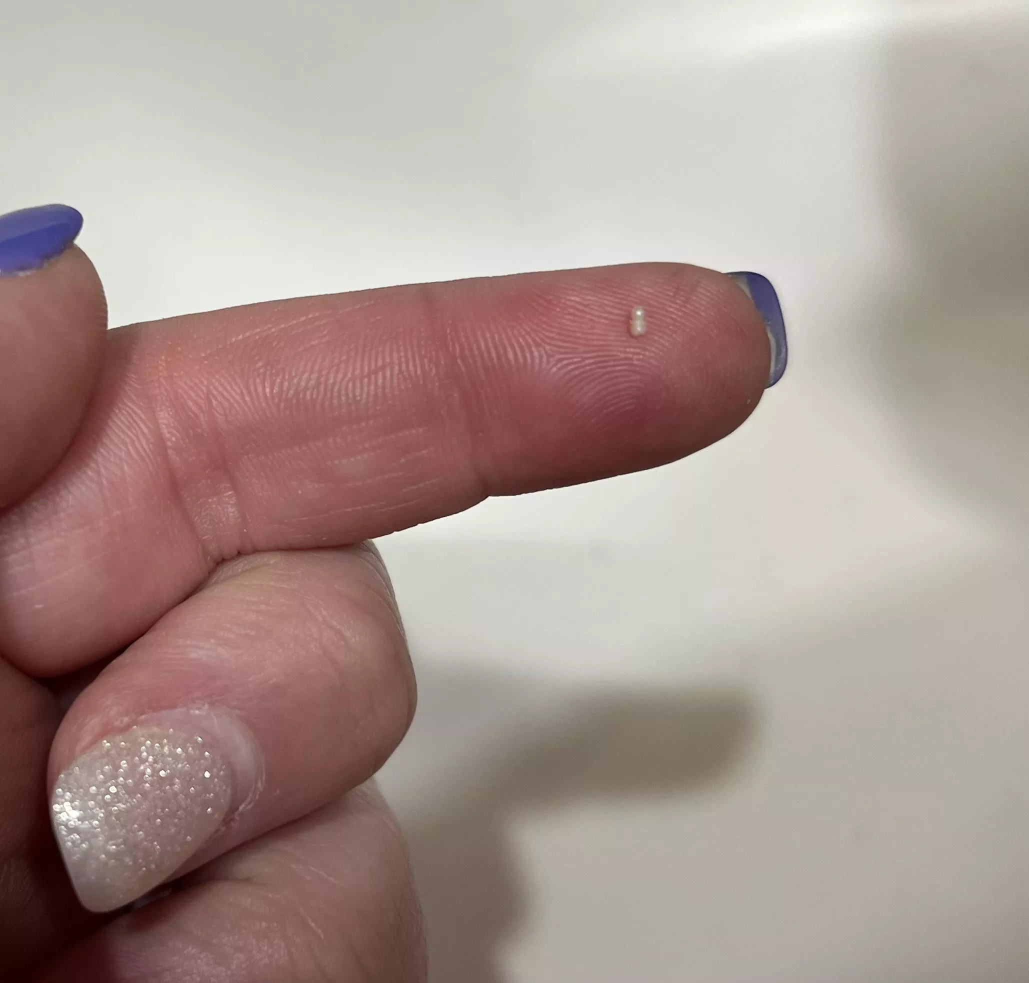 I had an itch on my thigh and scratched it, this little dude popped out. Not sure what it is. posted by Maureen87emma