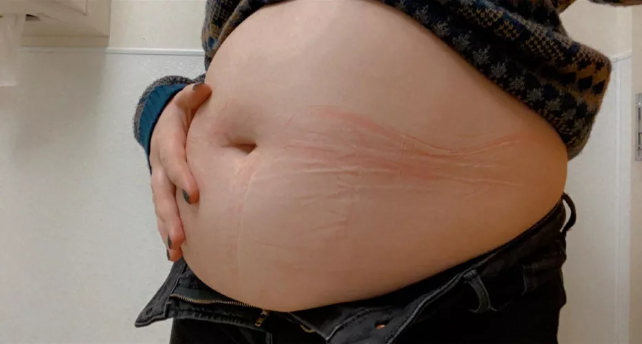 i had to free my belly after lunch 🤤🖤 by shylittlenymph