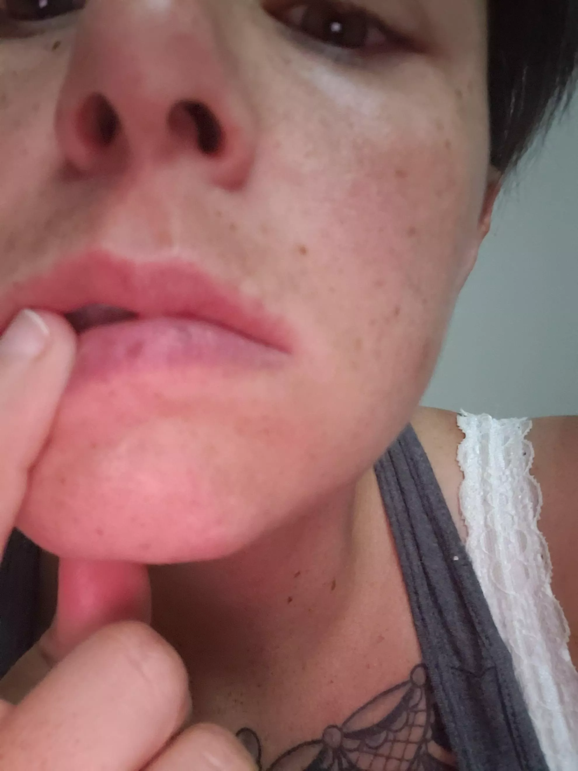 I have freckles on both my 💋 posted by Shortnsweet071