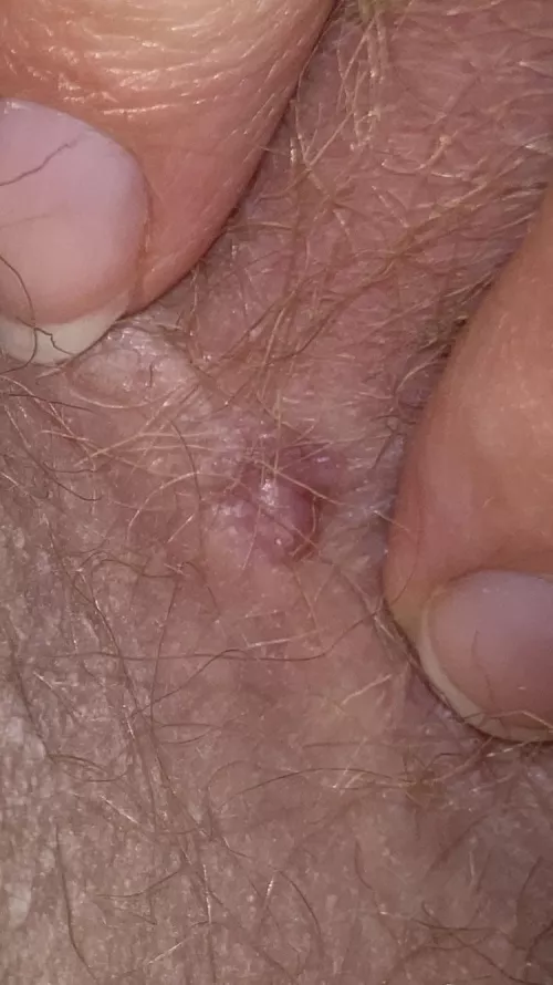 I have no idea what this thing is and it’s annoying me by Bearaf123