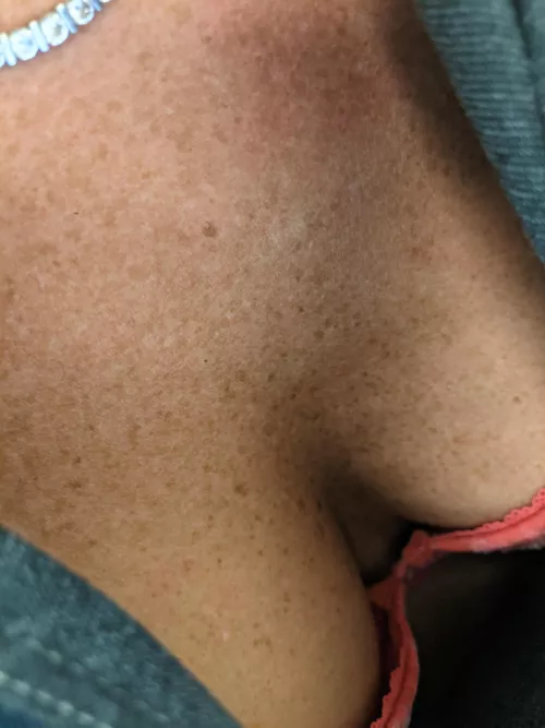 I hope my freckles are okay by grneyetenn