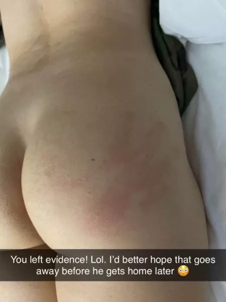 I hope that doesn’t leave a mark by ClubSandwich21