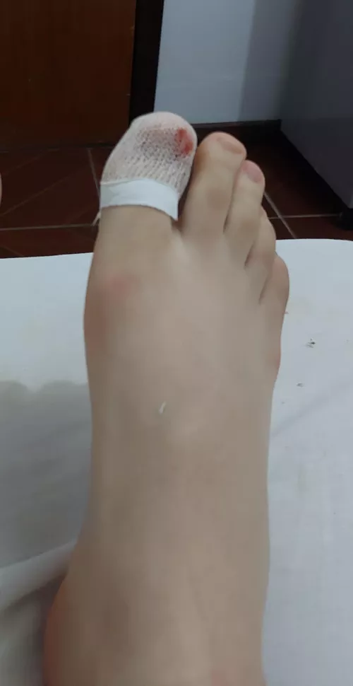 I hurt my toe 🥺🥺 can someone take care of it for me [19] by LukeCinnabun