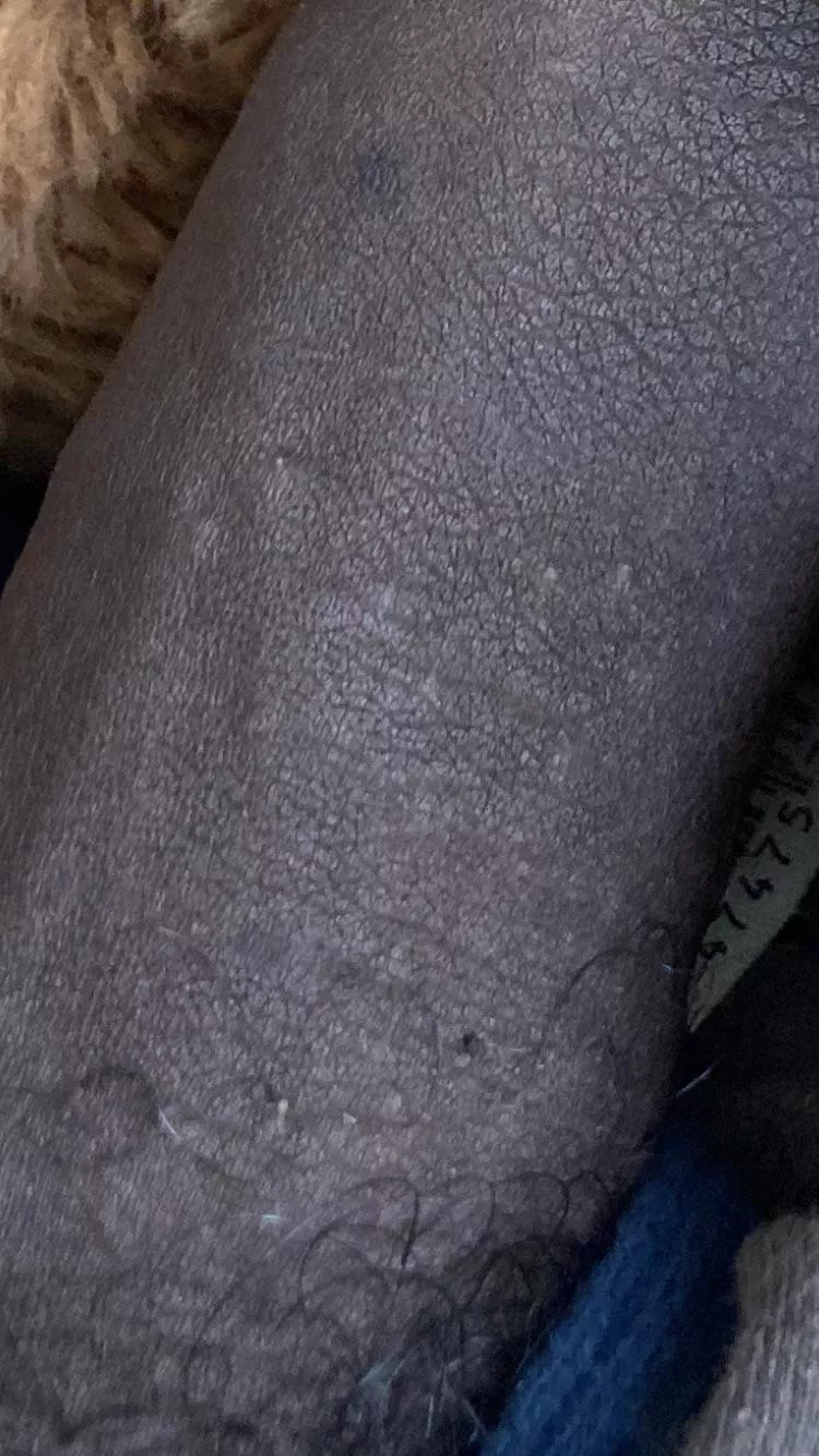 I just want to know if I’m ok why is my dick so black do that mean anything posted by Pittman0