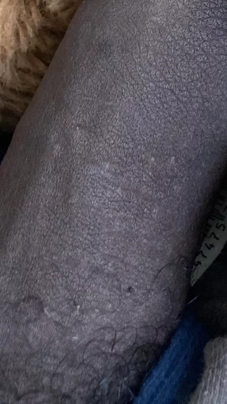 I just want to know if I’m ok why is my dick so black do that mean anything by Pittman0