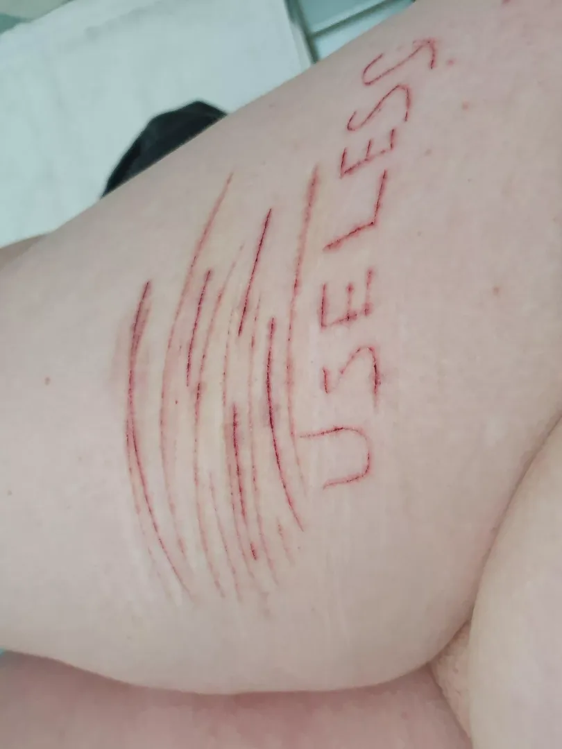 I know im your useless little whore daddy, so i carved it into my filthy piggy leg for you ehehehe posted by Undeadprincess420