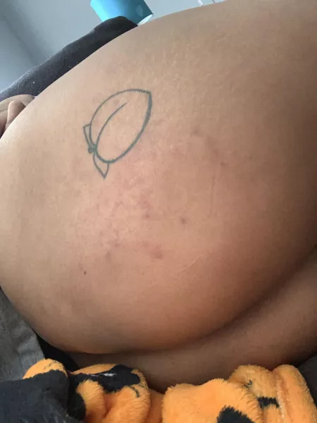 I love bruises by [deleted]