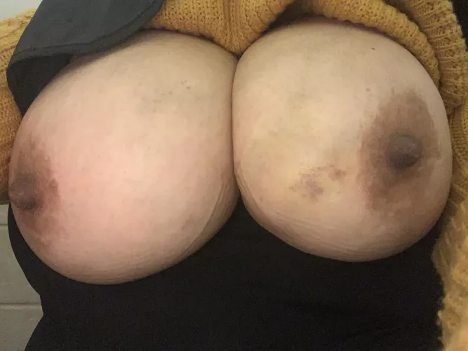 I love sucking adn biitng my wifes thick nipples! Who wants a try? by memorizeappearance
