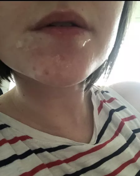 I missed my mouth 🥺 by kittykatlikestoplay