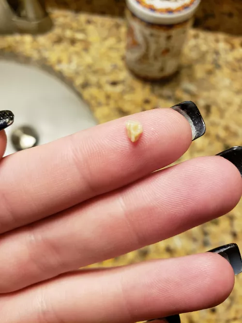 I nearly squealed when I coughed and found this tonsil stone! by irisrose248