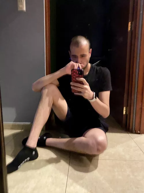 i recently got a hair transplant and i was scared to post pictures… but i’m trying to let my fears go and post pictures! by ferlozs