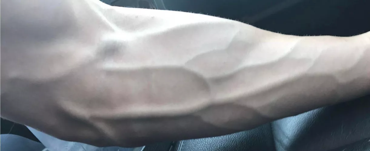 I repeat, this is NOT a dickpic by BWClosetfreak