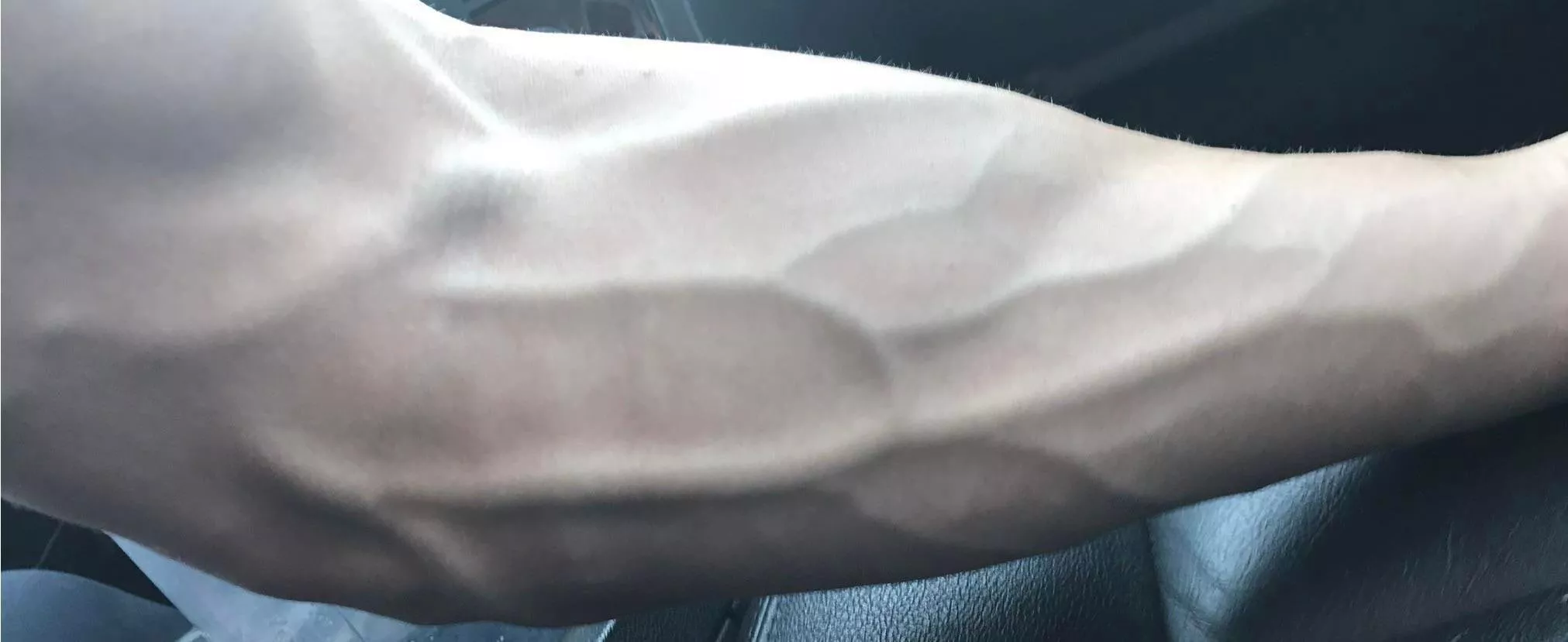 I repeat, this is NOT a dickpic posted by BWClosetfreak