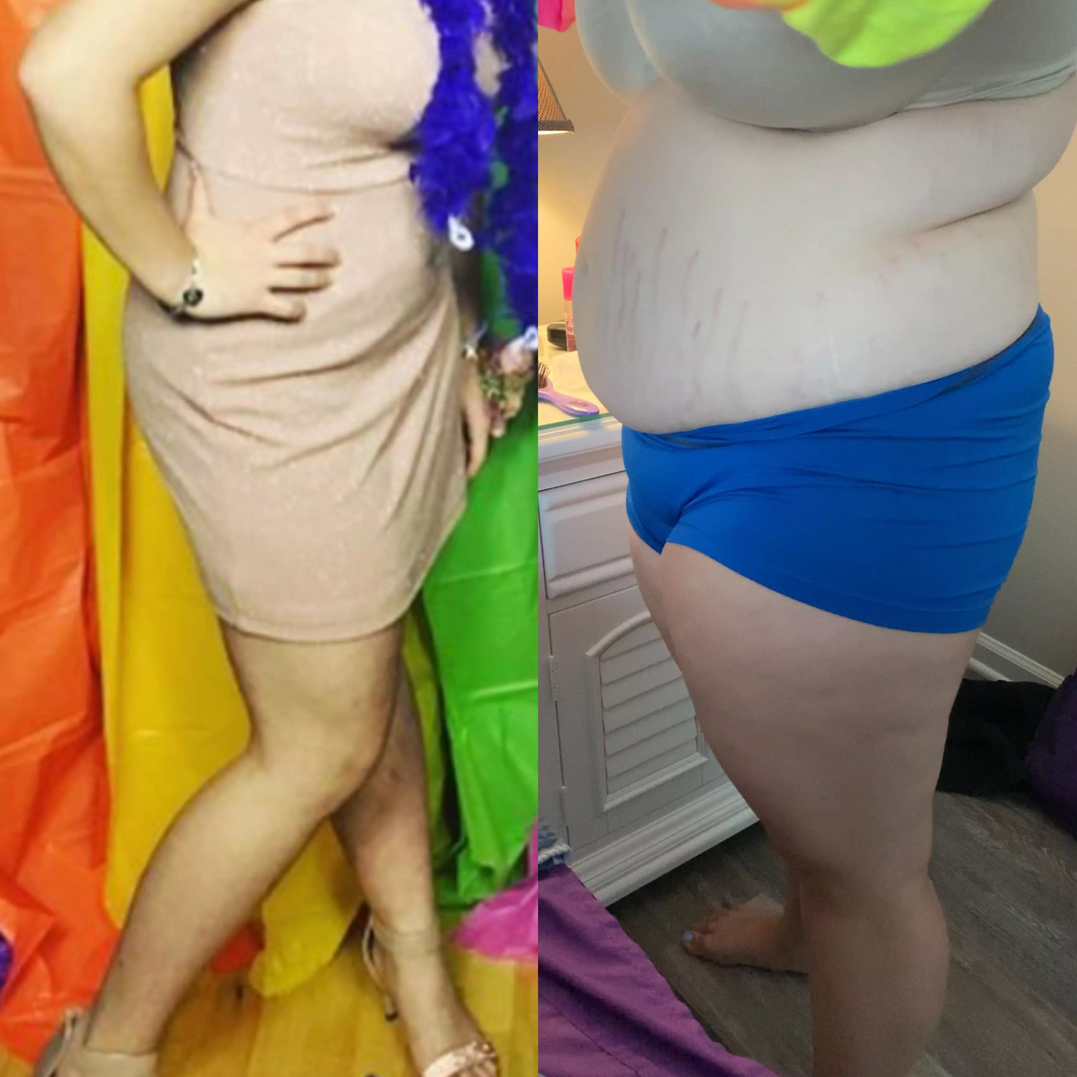 I think I deserve all the teasing after doing this to myself 😅 posted by LoverOfLife2019