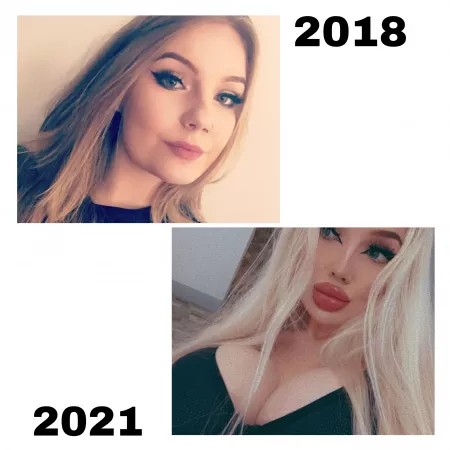 i think that my bimbofication is unbelievable🤯😈💋 i love my fake boobs and lips💋 by charlotteventurax