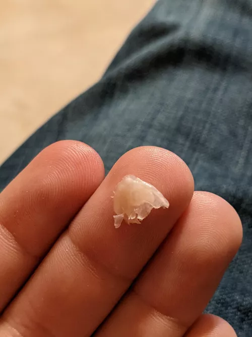 I think this is allowed: manage to cut out an ingrown toenail on my big toe. Cleaned up the blood so it's not as gross. Toe is cleaned/bandaged. by GreenFuzzyPotato